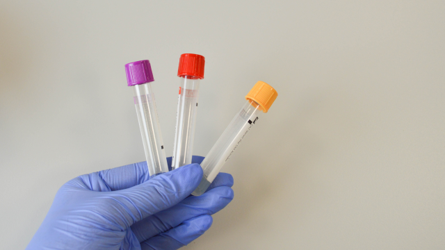A gloved hand holds three empty blood collection tubes with purple, red, and yellow colored caps against a plain background.